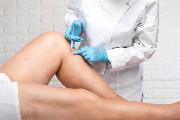 Understanding Chronic Venous Insufficiency 